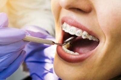 Haggling Over Price dentist