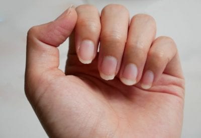 Parasites get under finger nails