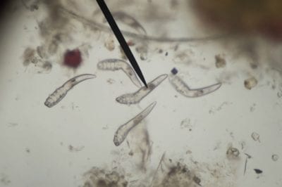 Parasites under microscope